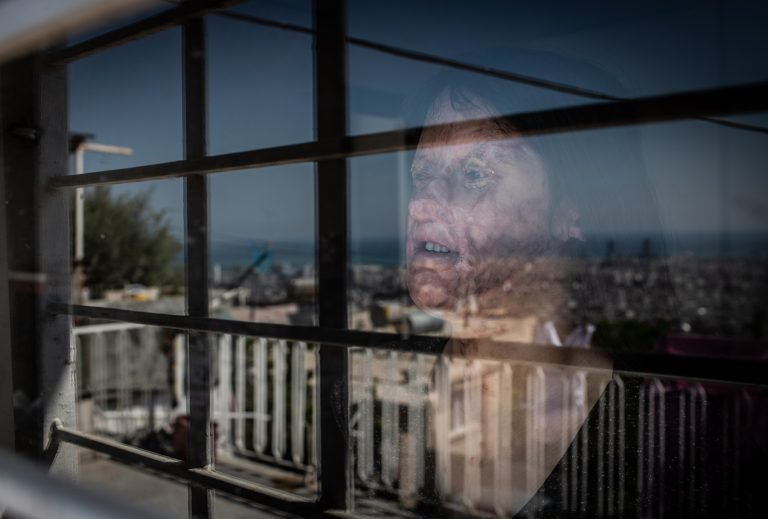 Berfin Ozek: Victim of an Acid Attack